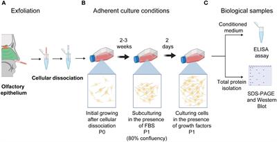 Human olfactory neural progenitor cells reveal differences in IL-6, IL-8, thrombospondin-1, and MCP-1 in major depression disorder and borderline personality disorder